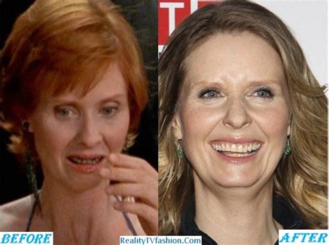 cynthia nixon teeth|miranda satc.